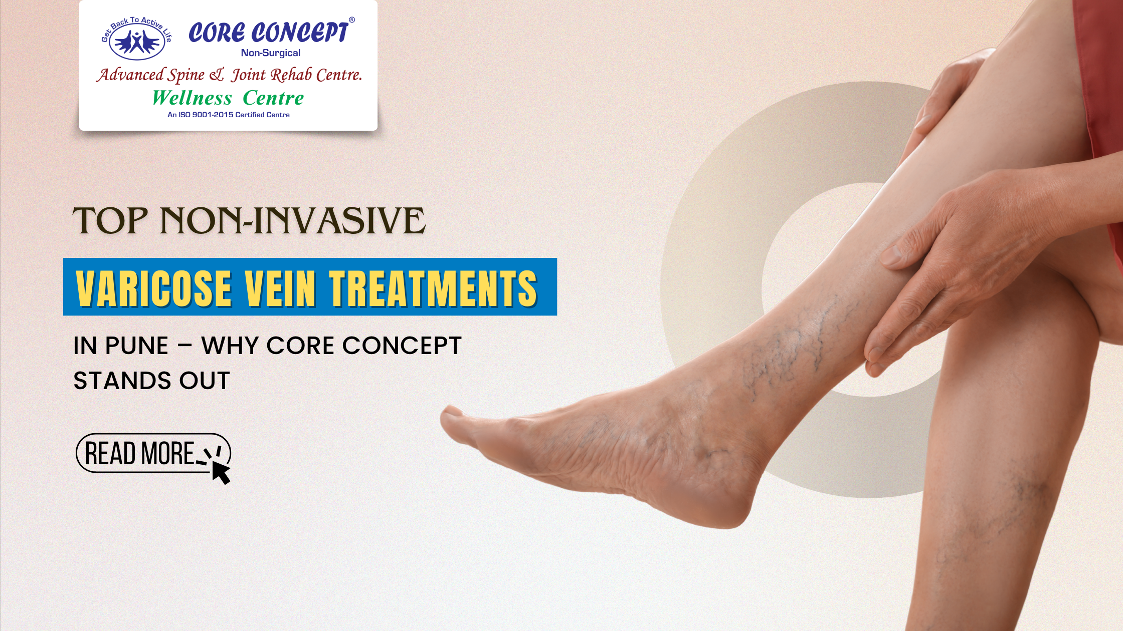 Top Non-Invasive Varicose Vein Treatments in Pune – Why Core Concept Stands Out